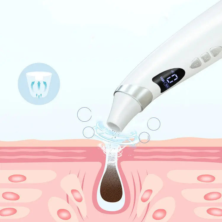 Smart Visual Blackhead Remover-1