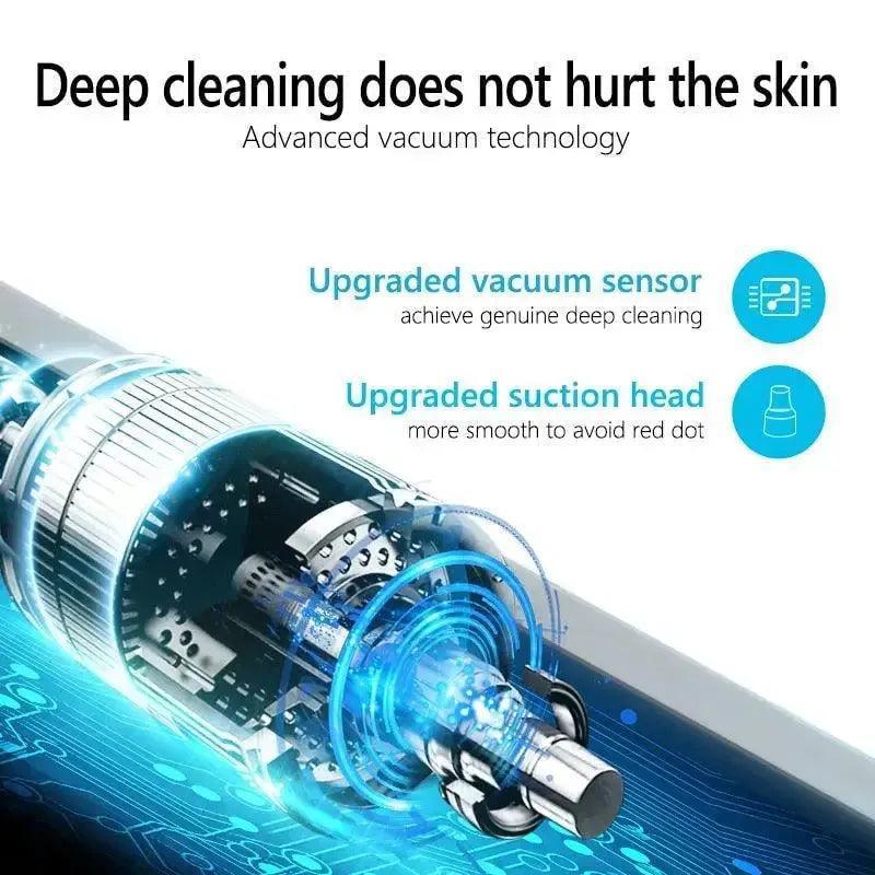 Facial Blackhead Remover Electric Acne Cleaner Device - petguardiansupplies