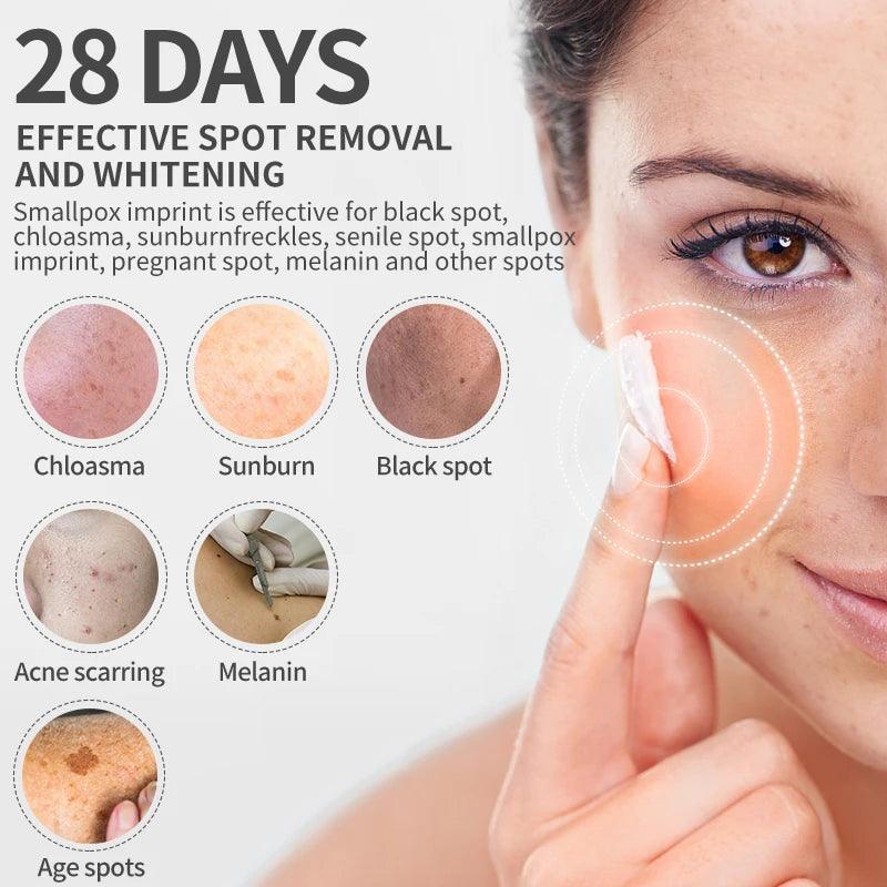 Dimollaure Whitening Freckle Cream Moisturize Firming Anti-Wrinkle Remove Dark Spots Melasma Melanin Bright Face Korea Skin Care - petguardiansupplies