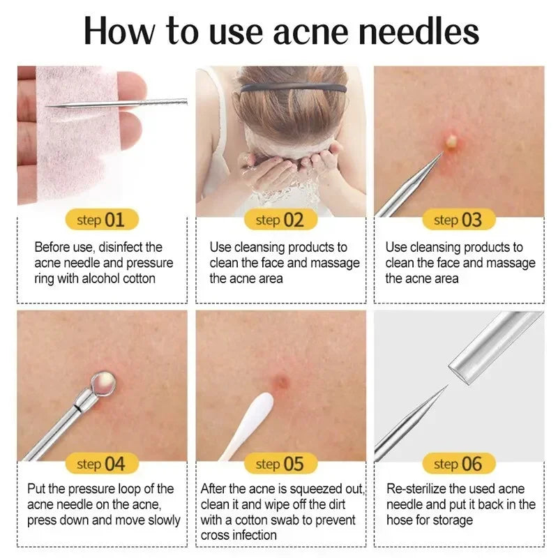 Professional Acne Needle Tweezers 11Pcs Ultra-fine No.5 Cell Pimples Blackhead Clip Facial Pore Cleaning Care Tool for Skin Care - petguardiansupplies