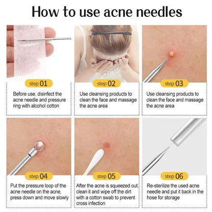 Professional Acne Needle Tweezers 11Pcs Ultra-fine No.5 Cell Pimples Blackhead Clip Facial Pore Cleaning Care Tool for Skin Care - petguardiansupplies