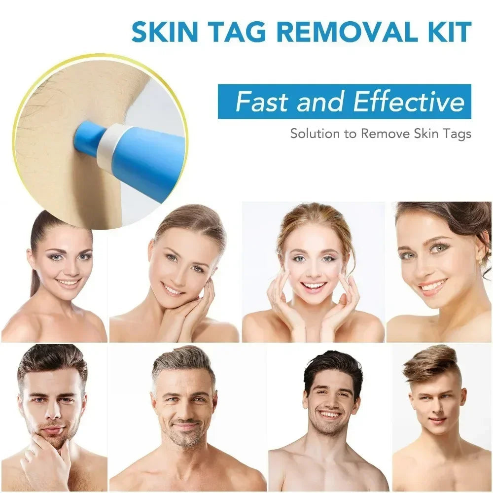 Painless Auto Skin Tag Mole Wart Removal Kit 2-in-1 Facial Body Care Treatments for Beauty Health - petguardiansupplies