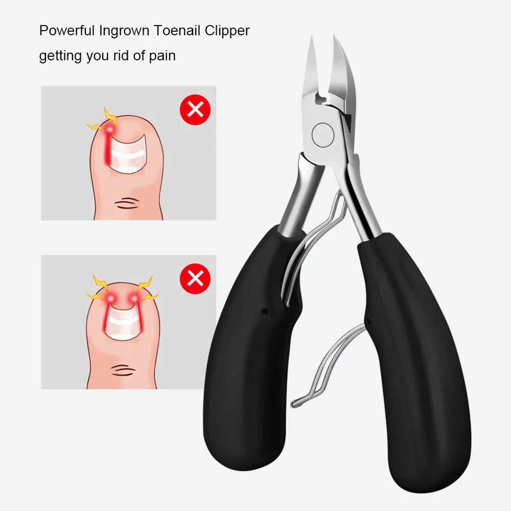 Ingrown Toenail Removal Kit 7PCS Foot Care Tool Nail Treatment Pedicure Clippers for Ingrown Toenail Lifter - petguardiansupplies